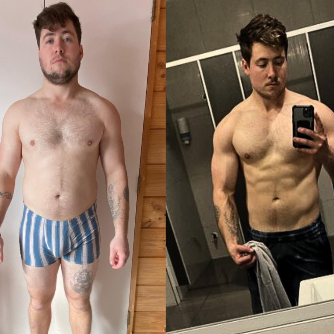 Finlay transformation
